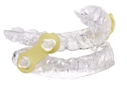 Oral Appliance for Sleep Apnea Treatment