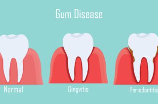 gum disease treatment tulsa ok