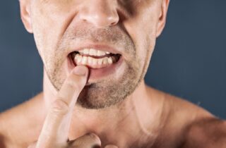 man using his index finger to pull down his lips and point to his gums bleeding gums crooked teeth gum disease dentist in Tulsa Oklahoma