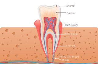 A Root Canal in Tulsa, OK, can help your oral health and comfort