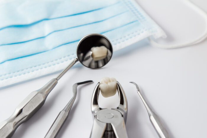 Teeth Extractions in Tulsa OK