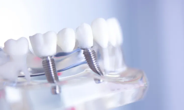 Dental Implants vs. Bridges: Which Is Right for You? in Tulsa, OK